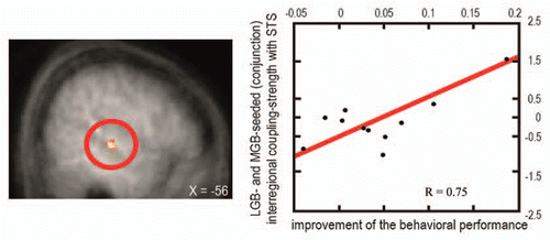 Figure 2 Brain-behavior relations for coupling of thalamic structures with higher association cortices as a function of behavioral performance. Right: The scatter plot depicts the relation between the size of the behavioral interaction pattern (i.e., the difference in subject's visual detection hit rate for sound minus no-sound conditions being more pronounced for lower-than higher-intensity visual targets; along the y-axis) and the significant changes in LGB- and MGB-seeded (conjunction) interregional coupling-strength (PPI, along the x-axis) with the remote region STS (shown on the left side). This analysis highlights stronger coupling of both LGB and MGB with multisensory STS for subjects with higher behavior benefit than for those with lower behavioral benefit (adapted from Noesselt et al.Citation53).