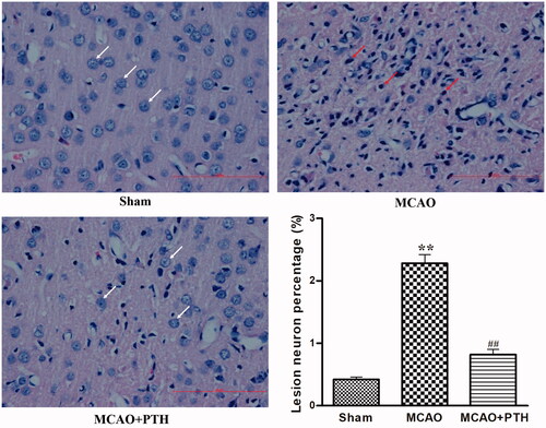 Figure 2. Effects of PTH on the cerebral histopathological changes in MCAO rats (n = 6). Haematoxylin-eosin-stained slides of the brain sections in different groups were examined under a light microscope. Normal neurons were arranged in a regular manner with intact structure (white arrow). Abnormal neurons exhibited obvious disordered arrangement, nuclei shrinkage and dark staining (red arrow). Scale bar = 100 μm.