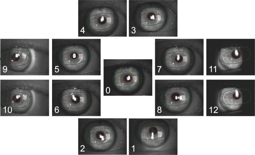 Figure 2 Images of different positions with overlays of the pupil shape and lens positions.