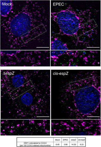 Figure 5. EspZ inhibits DRP1-mediated mitochondrial fission in EPEC-infected enterocytes. C2BBe cells were mock-treated or infected with WT EPEC, ∆espZ, or cis-espZ, and stained for COXIV (magenta), DRP1 (green), and DAPI (blue). Scale bar: 10 μm. Regions in hatched rectangles were enlarged in lower panels. Images shown are representative of >6 images captured from three independent experiments. Mean number of DRP1 puncta colocalized to the COXIV-stained mitochondria for each sample group is listed in the table. P values for specific sample group compared to mock are shown.