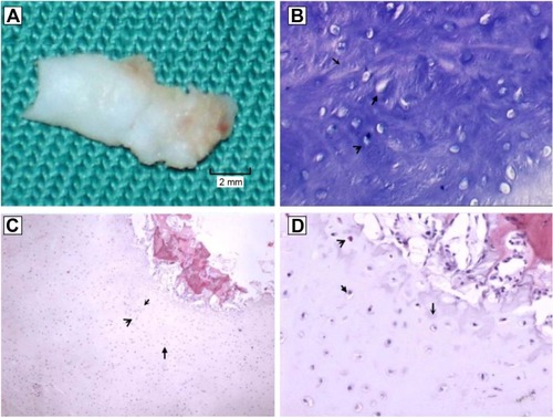 Figure 3 Histologic examination of the biopsies.