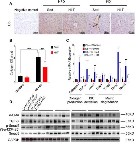 Figure 4 High-intensity interval training attenuated ketogenic diet-induced liver fibrosis. (A) Collagen production was compared between different groups by collagen I antibody staining. (B) Percentages of immunoreactive (collagen (I) areas in liver tissue sections were measured and expressed as relative values obtained by comparing the Db+HFD+Sed group of mice. (C) Gene expression analysis of collagen production, HSCs activation, and matrix degradation in the liver of diabetic mice of different groups. (D) Western blot analysis of mouse liver lysates by using specific antibodies against α-SMA, TGF-β, p-Smad3 (ser 423/425), or Smad3. Data were presented as means ± SD (n=6 each group). Groups were statistically compared using two-way ANOVA and Bonferroni post hoc test. Scale bars: 100 μm. *P <0.05, **P <0.01, compared to Db+HFD+Sed group, #P <0.05, ##P <0.01 compared to the Db+KD+Sed group.