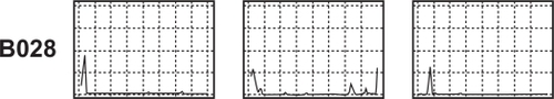 Figure 5 Serial sections of the same tissue (B028) immunostained for different epitopes (CD3, CD4, CD8; L to R) using specific monoclonal antibodies demonstrate that comparisons can be drawn between the distribution of different cell types within an individual tissue.