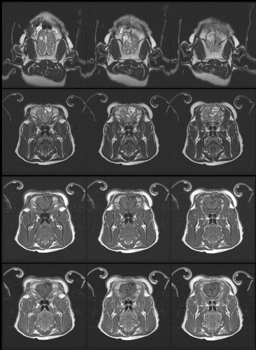 Figure 5. Brain MRI of a pig at one month after the hyperthermia treatment. (A) Axial T2 weighted images (B) Coronal T2 weighted images (C) Coronal T1 weighted images (D) Coronal T1 contrast enhanced images. MRI did not show any significant findings.