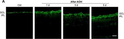 Figure 3 AAA attenuated induced Müller gliosis in the rat model of AOH.