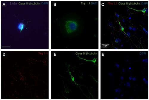 Figure S2 Expression of retinal ganglion cell (RGC)-specific markers in the primary rat retinal cell culture. A-B Immunofluorescence of primary rat retinal cell culture at day 1 of culture showed positive expression of Brn3a, Class III β-Tubulin (A) and Thy1.1 (B). Confocal triple immunofluorescence showed the co-staining of Thy1.1 (D), Class III β-Tubulin (E), and nuclear 4′,6-diamidino-2-phenylindole (DAPI) (F) in cells at day 3 of culture (merged image in C). The RGCs in culture showed dendritic outgrowth and elongation with axonal processes frequently contacting each other. A-B Magnification x80. C-F Magnification x60. Scale bars: 20 µm.