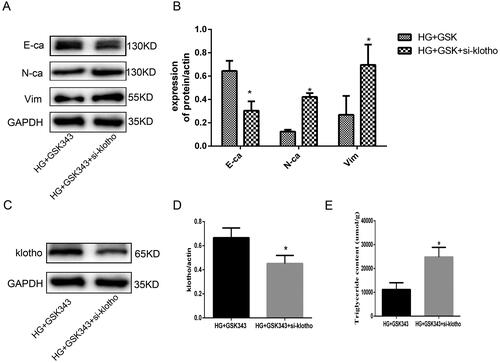 Figure 6. Rescue experiments showed that klotho mediated the protective effect of GSK343 on EMT and lipid accumulation. (A) WB revealed that the expression of E-cadherin, N-cadherin and vimentin was restored when HPMCs were treated with si-klotho compared with the HG + GSK343 group. (B) Quantitative analysis of the data shown in A. (C) WB revealed that the expression of klotho was restored when HPMCs were treated with si-klotho compared with the HG + GSK343 group. (D) Quantitative analysis of the data shown in C. (E) TG quantitative determination showed that the TG content was upregulated in the si-klotho + HG + GSK343 group compared with the HG + GSK343 group (Data are the mean ± SD; *p < .05 vs. HG + GSK343 group, n = 3).