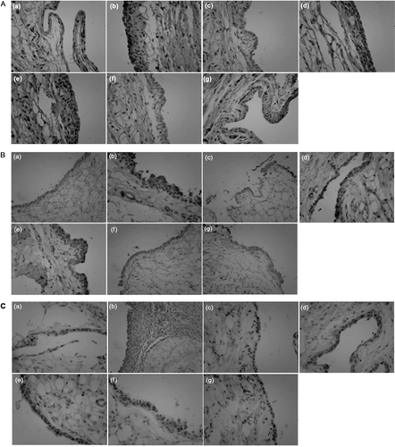 Figure 6.  Immunohistochemistry of p-Akt (A), PI3K (B) and TNF-α (C) in rat synovium. Representative serial sections from control, model and drugs treated rats are shown: (a) control group, (b) model group, (c) AR-6 high dose group, (d) AR-6 middle dose group, (e) AR-6 low dose group, (f) MTX group and (g) TGP group. Original magnifications, ×400.