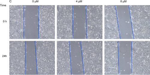 Figure 11 Inhibitory effects of VE-822 on GES 1 migration. The scratch width was reduced in a dose-dependent manner.