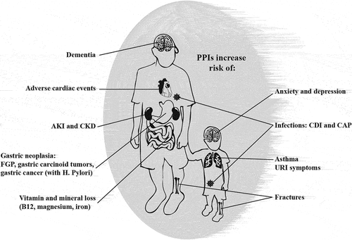 Figure 2. Reported PPI adverse effects in adult and pediatric populations. AKI = acute kidney injury; CKD = chronic kidney disease; FGP = fundic gland polyps; CDI = Clostridium difficile infection; CAP = community acquired pneumonia; URI = upper respiratory infection.