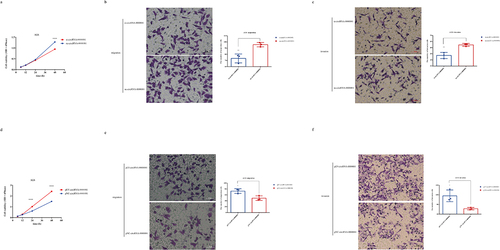 Figure 2. A. CCK-8 assay of AGS cells in the si-circRNA-0000081 group and nc-circRNA-0000081 group; b. Migration results of the Transwell assay of the si-circRNA-0000081 group and nc-circRNA-0000081 group (The samples were imaged at 200* magnification. Scale bar = 50 μm); c. Invasion results of the Transwell assay of AGS cells transfected with si-circRNA-0000081 and nc-circRNA-0000081 (The samples were imaged at 200* magnification. Scale bar = 50 μm); d. CCK-8 assay of AGS cells in the pLV-circRNA-0000081 group and pNC-circRNA-0000081 group; e. Migration results of the Transwell assay of the pLV-circRNA-0000081 group and pNC-circRNA-0000081 group (The samples were imaged at 200* magnification. Scale bar = 50 μm); f. Invasion results of the Transwell assay of AGS cells transfected with pLV-circRNA-0000081 and pNC-circRNA-0000081 (The samples were imaged at 200* magnification. Scale bar = 50 μm).