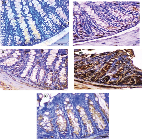 Figure 6. Photomicrograph of colorectal sections post-6 weeks showing AIF immunohistochemical staining through the mucosal layer, with (a) negative staining in the EDTA group, (b) moderate staining in the DMSO group, (c) moderate staining in the Nic group, (d) strong staining in the DMH group, and (e) mild staining in the Nic-DMH group. Scale bar: 50 µm.
