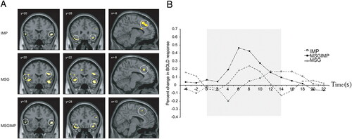 Figure 3. (A) Cortical activation maps produced by inosine 5’-monophosphate (IMP), monosodium glutamate (MSG), and a combination of the MSG and IMP (MSGIMP) in the insula/operculum area, the orbitofrontal cortex (OFC), and the anterior cingulate cortex. (B) Timecourses of cortical activation to IMP, MSG, and MSGIMP in the OFC showing the supra-additivity effects of the combination of the MSG and IMP. Figures modified from De Araujo et al. (Citation2003) (De Araujo, Kringelbach, Rolls, and Hobden Citation2003) and reproduced with authors permission.
