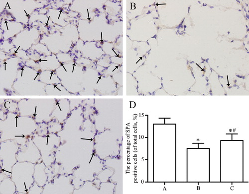 Figure 4. Immunohistochemical analysis of the expression of SPA in lung parenchyma from control group (A), emphysema group (B), and emphysema + SRT2104 group (C). The arrows indicate the SPA positive cells. Magnification, ×400. (D) The percentage of SPA positive cells in each group. Values are presented as mean ± SD (n = 15). *p < 0.05 vs. group A; #p < 0.05 vs. group B.