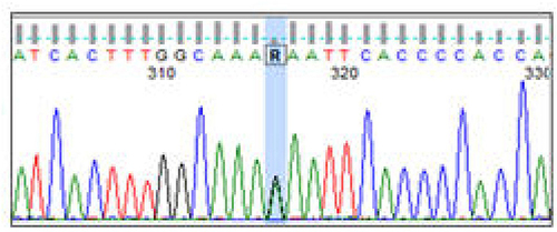 Figure 4 The heterozygous Hb O-Arab variant (HBB):c.364G>A (p.Glu122Lys). Partial chromatogram representing sequencing analysis of intron two and exon 3 of the beta-globin gene.