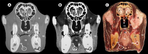 Figure 1. (A) Bone window CT image, (B) soft-tissue window CT image and (C) anatomic section at the level of the olfactory bulb.All views are rostral. 1, frontal sinus; 2, cribriform plate of ethmoid bone; 3, frontal cortex; 4, olfactory bulb; 5, sphenoidal sinus; 6, extraperiorbital fat; 7, zygomatic process of temporal bone; 8, body of presphenoid bone; 9, vomer bone; 10, tensor and levator palatine muscles; 11, pars nasalis pharyngis; 12, perpendicular plate of palatine bone; 13, upper third molar; 14, soft palate; 15, masseter muscle; 16, oral cavity; 17, lower third molar; 18, tongue and lingual fat; 19, hyoid bone; 20, mandibular canal.