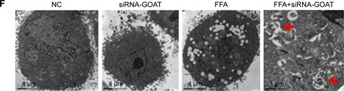 Figure 5 GOAT inhibition-induced lipid clearance is associated with a concomitant increase in autophagy in LO2 cells or mice livers.