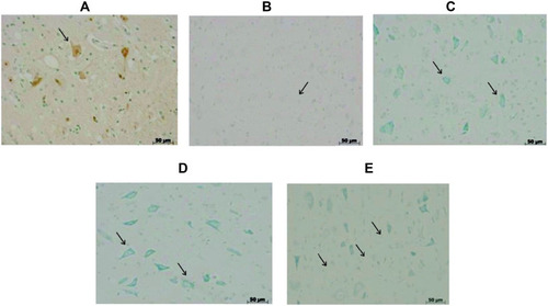 Figure 7 TUNEL assay of spinal cord tissue of mice subjected to spinal injury followed by treatment of PHP, ZFL and their combination.
