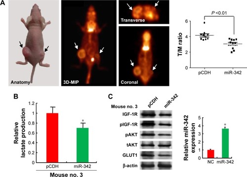 Figure 4 miR-342-3p/IGF1R axis regulates glycolysis and tumor growth in vivo.