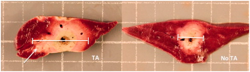 Figure 4. Gross tissue sections of porcine liver following in vivo microwave ablation with and without 1 ml thermal accelerant at the 250 mg/mL dose. Ablation with TA (left) yielded a significantly larger ablation zone than without TA (right). Note the visible TA injection mark (white arrow). Each grid measures 1 cm2.