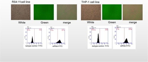 Figure 2 Detection of siRNA transfection efficiency. Transfection of the RS4:11 cells and the THP-1 cells with the plasmid resulted in an intracellular distribution of the green fluorescence. Upper: The green fluorescent proteins were observed under a fluorescence microscope to calculate the transfection rate (left: 95%, in RS4:11 cells; right: 91% of THP-1 cells). Lower figure: Detection of the transfer efficiency was observed by flow cytometry (left: 85% of RS4:11 cells, right: 89% of THP-1 cells).