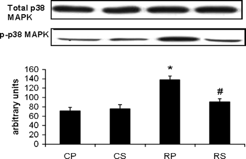 Figure 3  The effect of restraint and Sutherlandia supplementation on p38-MAPK phosphorylation in gastocnemius muscle. Samples were analysed by western blotting with antibodies recognizing the dual phosphorylated MAPK. Results are expressed as means ± SEM for eight independent experiments, *p < 0.001 vs. CP; #p < 0.01 vs. RP, F = 15.5. CP, control placebo; CS, control Sutherlandia; RP, restraint placebo; RS, restraint Sutherlandia.