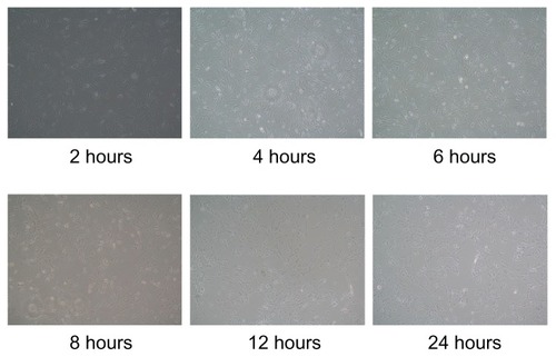 Figure 8 Influence of microemulsion incubation time on cellular morphology.