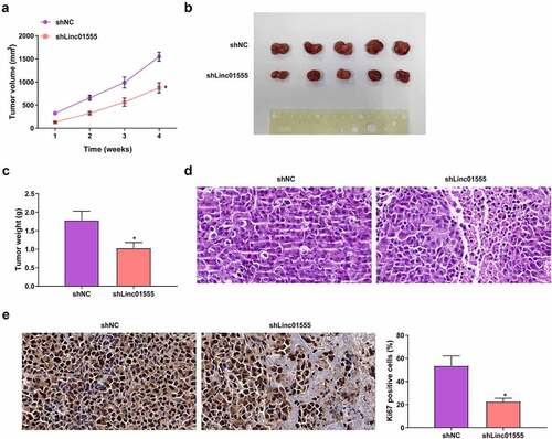 Figure 8. Down-Regulation of linc01555 restrains tumorigenesis and DDP resistance in vivo. Measurement of tumor volume weekly; (b) Tumor images after 4 weeks; (c) Tumor weight measured 6 weeks later. (d) Histopathological changes were observed by HE staining. (e) the positive expression of Ki67 was detected by immunohistochemistry. * P <0.05, vs. The shNC.