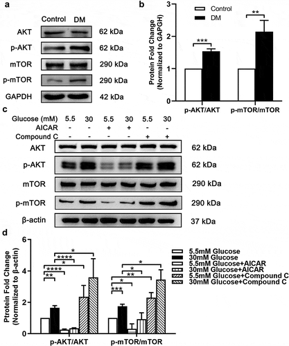 Figure 3. mTOR and AKT were up-regulated in both anterior capsule LECs from DC patients and SRA 01/04 under HG condition. (A) Proteins were extracted from the anterior capsules of DC and ARC patients (control) and then probed for total AKT and p-AKT, total mTOR and p-mTOR. GAPDH was used as a loading control. (B) Quantification of p-AKT/AKT and p-mTOR/mTOR expression levels in A. Fold change relative to the level of control groups is displayed. **P < .01, ***P < .001, n = 3. (C) SRA 01/04 were supplemented with 30 mM and 5.5 mM glucose and incubated for 48 hours. For experimental group, cells were treated with 1 mM AICAR and 10 mM Compound C for 48 hours respectively at the same time. Proteins were extracted and then probed for p-AKT/AKT and p-mTOR/mTOR. Without AICAR or Compound C treated LG (5.5 mM) cultured SRA 01/04 were used as control groups. β-actin was used as a loading control. (D) Quantification of p-AKT/AKT and p-mTOR/mTOR expression levels in C. Fold change relative to the level of control groups is displayed. *P < .05, **P < .01, ***P < .001, ****P < .0001, n = 3