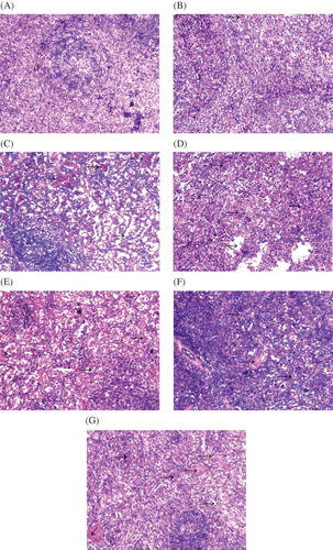 Figure 2. Change of spleen histomorphology in two rabbit models of ARF (hematoxylin and eosin staining, ×100). (A) Control group; (B) HgCl2-treated group at 12 h; (C) HgCl2-treated group at 24 h; (D) HgCl2-treated group at 48 h; (E) glycerin-treated group at 12 h; (F) glycerin-treated group at 24 h; (G) glycerin-treated group at 48 h. Arrows show congestion in C, E, and F and trabeculae lienis in D and G.