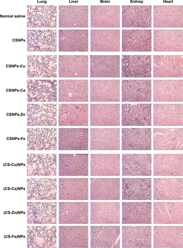 Figure S6 Biocompatibility study.Note: Sections of different organs stained with hematoxylin and eosin.Abbreviations: CSNPs, chitosan nanoparticles; CS, chitosan; NPs, nanoparticles.
