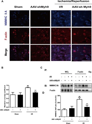 Figure 5 NMMHC IIA inhibition attenuates I/R-induced NMMHC IIA-actin interaction in mice. (A) Representative images of each group were shown. Mice in each group were sacriﬁced 24 hrs after the MCAO/R. Confocal microscopy was used to detect the expression of NMMHC IIA (blue) and F-actin (red). Bar: 50 µm. (B) The quantitative colocalization of NMMHC IIA with F-actin was evaluated on the basis of Manders’ overlap coefficients. (C) Co-IP of NMMHC IIA and F-actin was detected by Western blots with indicated antibodies. The bands of left panel are from whole-cell lysates (WCL) and the bands of right panel are the same as shown on the left but immunoprecipitated with indicated antibodies. After MCAO/R, ischemic brain tissue lysates were subjected to immunoprecipitation with anti-F-actin antibody, and then the precipitates were analyzed by immunoblotting with anti-myosin IIA and anti-F-actin antibodies. Normal IgG was loaded as positive and negative controls. (D) Quantification of NMMHC IIA co-immunoprecipitated with F-actin in mice. Results were expressed as mean±SD from three independent experiments. ##P< 0.01 versus sham group, **P< 0.01 versus I/R group.