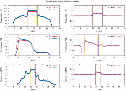 Figure 3. Steady state temperature profile along the cardinal axes, through the bladder’s center of gravity, for a typical patient (patient #6). Vertical purple lines show the outside of the bladder wall, yellow lines the interface between the bladder contents and the bladder wall and the red line the interface between the bladder contents and the air pocket. It is observed that the air pocket causes the bladder contents, and hence the bladder wall in contact therewith, to be slightly warmer, the effect increasing towards the air pocket. The air pocket itself, and the part of the bladder wall in contact therewith, however, are cooler than they would be in the absence of an air pocket. Shown are profiles for the patient’s left-to-right (top), anterior-posterior (middle) and caudal-cranial (bottom) directions.