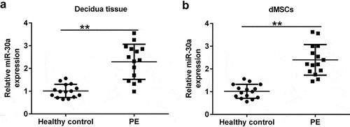 Figure 1. MiR-30a levels were increased in the decidua tissue and decidua MSCs (dMSCs) of patients with pre-eclampsia (PE) Quantitative reverse transcription-polymerase chain reaction (qRT-PCR) analysis of miR-30a levels in decidua tissue (a) and dMSCs (b) from healthy pregnancies and patients with PE. **P < 0.01.