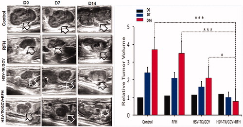 Figure 6. Ultrasound imaging follow-up of rat orthotopic ovarian tumors in four different treatment groups (PBS, RFH alone, HSV-TK/GCV alone, HSV-TK/GCV plus RFH), which demonstrated a significant decrease in tumor size for the combination therapy group compared to the other three groups (*p<.05, ***p<.001).