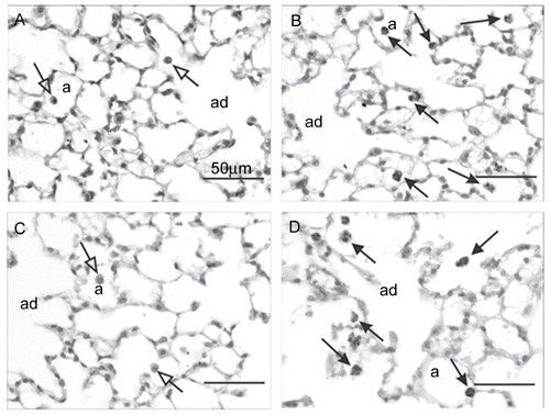 Figure 3.  Light photomicrographs of alveolar parenchyma from the lungs of filtered air alone- and cigarette smoke (CS)-exposed nulliparous and parous mice 24– 48 hr post-exposure. Alveolar parenchyma is shown from mice in experimental groups ACNP (A), CSNP (B), ACP (C), and CSP (D). A few, widely scattered, histologically normal alveolar macrophages (arrows with open arrowheads) can be seen in the air control mice (A and C). Increased numbers of slightly hypertrophic alveolar macrophages containing phagocytized dark brown/black particles (arrows with closed arrowheads) are apparent in the smoke-exposed groups (B and D). a = alveolar airspace; ad = alveolar duct airspace. No histological features of alveolar inflammation or epithelial proliferation were present in any of the lung sections. Tissues sections were stained with H & E and examined at 100 X magnification.