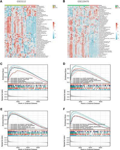 Figure 7 GSVA and GSEA analysis (A and B) Heatmap showing the GSVA scores of potential pathways and biological processes in GSE128470 and GSE3112. (C-F) GSEA showing the different pathways and biological processes enriched in IBM.