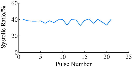 Figure 16. Heart systolic ratio when combining the electrocardiogram and heart sound.