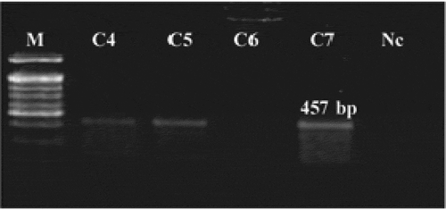 Figure 6. RT-PCR analysis of the katE gene mRNA in T2 modified tomato lines. C4, C5, and C7: modified lines no. 4–7; Nc: non-modified plant; M: 100 bp DNA ladder