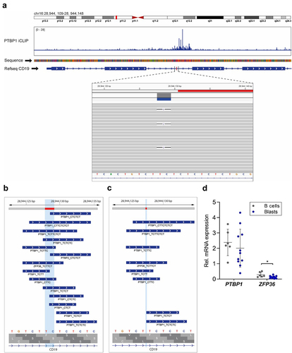 Figure 1. A blast-specific mutation in CD19 intron 2 affects RBP binding domains(a) Localization of CD19 on chr.16 p11.2 (upper panel, red square). Bar diagram showing PTBP1 iCLIP2 crosslink events on each nucleotide of endogenous CD19 exon 1–4. Lower panel shows and overview of CD19 exon 1–4, highlighting the position of the mutation in intron 2 in red. Detailed view of the DNA segment harboring the mutation site and single reads carrying the TTC>T mutation (box). Alignments are visualized with Integrative Genomics Viewer (IGV). (b, c) RBPs and binding motifs in the WT (A) and mutated sequence (b) overlapping the respective DNA locus. Nucleotides being affected by the deletion are highlighted in light blue. All binding motifs ≥4 nucleotides suggested by ATtRACT are displayed. (d) qRT-PCR analysis of PTBP1 and ZFP36 in sorted B cells and leukemic blasts of pediatric healthy donors and B-ALL patients (n = 6 patients in control, n = 11 patients in diseased group; *, p < .05).