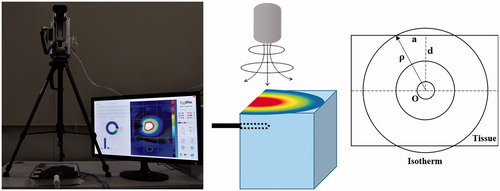 Figure 1. Ex vivo bovine radiofrequency ablation experimental setup for infrared thermography. (A) Infrared camera placed 30 cm above liver, which is in tray with ablation electrode in position; temperature–proximity image is pictured on monitor; (B) animation with infrared camera above block of liver tissue, ablation electrode in position and temperature–proximity illustration on top of tissue block; and (C) coronal plane diagram of tissue demonstrates cross-section of RFA electrode (O), distance from electrode to margin of ablated zone on liver surface (P), radius of ablated zone on liver surface (a) and vertical distance from electrode to liver surface (d), which was set at 1.0 cm. Isotherm line identifies points having the same temperature, which occurred along the margin of the ablation zone.