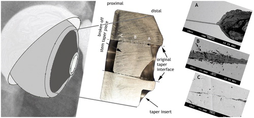 Figure 4. Left panel: Orientation of cup and head in case 2. Middle panel: Aligned orientation of the cut ball head insert with the fractured stem taper piece (dashed lines: original taper surface; areas A, B, and C for SEM are highlighted). Right panel: A. SEM of the corrosion cavity at the location of conversion to a smaller gap. B. SEM image of the middle of the taper articulation. The line down the middle of the dark TiO2 layer marks the location of the original metal interface. The bulk titanium material was converted directly to TiO2 by corrosion. C. SEM of the proximal end of the articulation. Tight junction between male and female taper surfaces with asperity contact and thin oxide layer.