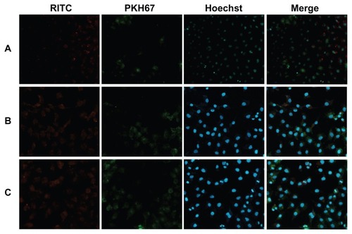 Figure 6 Fluorescence images of competitive cellular uptake of RITC-labeled magnetic nanoparticles for 12 hours. A549 cells (HER2-negative, cytoplasmic membrane-labeled with PKH67 fluorescent linker, green) cocultured with HER2-overexpressing SKOV-3 cells were incubated with RITC-labeled magnetic nanoparticles (red). (A) LTVSPWY-PEG-CS-modified magnetic nanoparticles, (B) PEG-CS-modified magnetic nanoparticles, and (C) chitosan-modified magnetic nanoparticles.Note: The cells were all stained with Hoechst 33342.Abbreviations: RITC, rhodamine B isothiocyanate; PEG, poly(ethylene glycol); CS, chitosan.