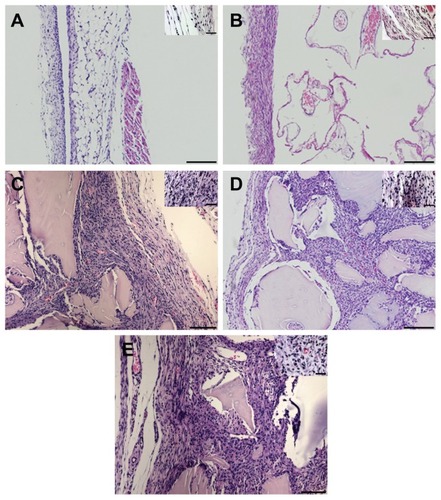 Figure 1 The histological appearance of air pouch membranes from mice implanted with saline (A), ProOsteon® (B), DBX® (C), Accell Connexus® (D), and Accell DBM-100™ (E). Original magnification = 50× (A, B, D) or 100× (C, E) for larger photographs (Bars = 500 microns), 200× for smaller insets (Bars = 100 microns).
