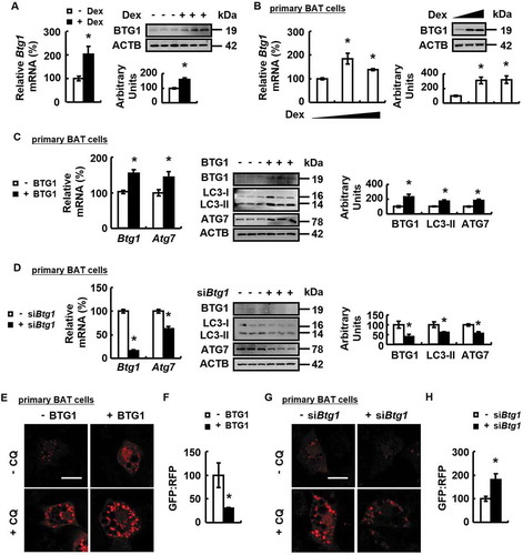 Figure 4. Dex increases BTG1 expression and BTG1 regulates autophagy. (A) Btg1 mRNA (left) and protein levels (right) were analyzed in BAT of male WT mice i.p. injected with Dex (+ Dex) or PBS (- Dex) for 1 week. (B) Btg1 mRNA (left) and protein levels (right) were analyzed in primary cultured brown adipocytes treated with 0, 1 or 5 μM Dex for 24 h. (C) Btg1 and Atg7 mRNA (left) and protein levels (right) were analyzed in primary cultured brown adipocytes transfected with (+ BTG1) or without (- BTG1) plasmids overexpressing BTG1 for 48 h. (D) Btg1 and Atg7 mRNA (left) and protein levels (right) were analyzed in primary cultured brown adipocytes transfected with (+ siBtg1) or without (- siBtg1) Btg1 siRNA for 72 h. (E) Confocal micrographs of primary cultured brown adipocytes transfected with (+ BTG1) or without (- BTG1) plasmids overexpressing BTG1 for 24 h, prior to being treated with CQ (+ CQ) or PBS (- CQ) for 24 h. (F) Autophagic flux was measured in primary cultured brown adipocytes transfected with plasmids expressing GFP-LC3-RFP-LC3△G, concomitantly with (+ BTG1) or without (- BTG1) plasmids over-expressing BTG1 for 48 h. (G) Confocal micrographs of primary cultured brown adipocytes transfected with (+ siBtg1) or without (- siBtg1) Btg1 siRNA for 48 h, prior to being treated with CQ (+ CQ) or PBS (- CQ) for 24 h. (H and K) Autophagic flux was measured in primary cultured brown adipocytes transfected with (+ siBtg1) or without (- siBtg1) Btg1 siRNA for 24 h, prior to being transfected with plasmids expressing GFP-LC3-RFP-LC3△G for 48 h. (I and J) Btg1 and Atg7 mRNA (left) and protein levels (right) (I), confocal micrographs (J) of primary cultured brown adipocytes transfected with (+ siBtg1) or without (- siBtg1) Btg1 siRNA for 48 h, prior to being treated with Dex (+ Dex) or PBS (- Dex) for 24 h. (L) HEK 293T cells were co-transfected with (+ MYC-CREB1) or without (- MYC-CREB1) MYC-tagged CREB1 plasmids, with (+ FLAG-BTG1) or without (- FLAG-BTG1) FLAG-tagged BTG1 plasmids. Immunoprecipitation (IP) and immunoblotting (IB) were performed using the antibodies indicated. (M) Luciferase activity was assessed in HEK293T cells expressing the Atg7 promoter vectors, co-transfected with (+ CREB1) or without (- CREB1) plasmids overexpressing CREB1, with (+siBtg1) or without (-siBtg1) Btg1 siRNA for 72 h, or with (+BTG1) or without (-BTG1) plasmids overexpressing BTG1 for 48 h. Scale bars: 20 μm in E, G and J. Data are represented as mean ± SEM. Statistical significance was calculated using the two-tailed Student t-test for the effects of with compared to without Dex in A and B, or the effects of BTG1 overexpression or knockdown versus the control group in C, D, F and H (*: p < 0.05); or one-way ANOVA followed by the Student-Newman-Keuls (SNK) test for the effects of any group versus the control group (*: p < 0.05), with versus without Dex in Btg1 siRNA group (#: p < 0.05), with versus without Btg1 siRNA in Dex group (&: p < 0.05) in I and K, with versus without BTG1 overexpression or knockdown in CREB1 group (#: p < 0.05) in M.