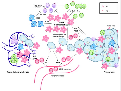 Figure 1. Model showing the central role of CD14+ M2-macrophage-like cells in the immune suppression in cervical cancer. CD14+ monocytes are recruited from the peripheral blood by tumor-derived CCL2, produced by metastasizing tumor cells. In the presence of interleukin (IL)-6 and prostaglandin-E2 (PGE2), these monocytes become converted in the microenvironment of the tumor-draining lymph nodes and the primary tumor into CD14+ M2-macrophages expressing programmed death-ligand 1 (PD-L1). These suppressive CD14+ M2-macrophages promote progression and early metastasis of the primary tumor by producing pro-angiogenic and tumor-invasive factors. In addition, they can bind to PD-1 on antitumor effector T cells, thereby inhibiting an immune response against the primary and metastatic tumor cells. This immunosuppressive cycle is further amplified by the interplay and crosstalk of regulatory T cells (Treg) and myeloid-derived suppressor cells (MDSC).