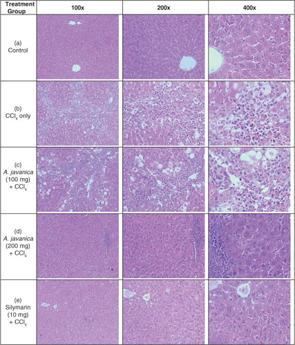 Fig. 2 The histopathology of experimental rat liver at 100×, 200×, and 400× magnifications. Histograms showing the following: (a) healthy tissues with normal hepatocytes and central vein; (b) CCl4-injured tissue with necrosis and fatty degenerative changes; (c) tissue with congested central vein with necrosis and fatty changes after A. javanica (100 mg) + CCl4 treatment; (d) liver with normal hepatocytes and central vein with full recovery after A. javanica (200 mg) + CCl4 treatment; and (e) liver with normal hepatocytes and fully recovered central vein after silymarin (10 mg) + CCl4 treatment.