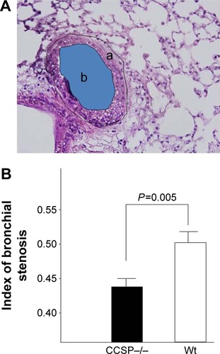 Figure 4 Stenosis of the bronchus after chronic Pseudomonas aeruginosa infection.Notes: (A) The index of bronchial stenosis was investigated by morphometry. The area of the external bronchus (a) and the bronchial lumen (b) was measured by a software program. (B) Then the index (area b/area a) was calculated. The bronchus of the club cell secretory protein-deficient (CCSP−/−) mice showed significantly greater stenotic development in comparison to wild-type mice. Four CCSP−/− mice and three wild-type mice were used.Abbreviation: Wt, wild-type.