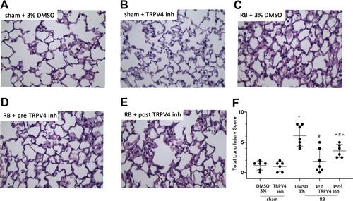 Figure 2 Histological analysis of lung tissue sections following resistive breathing and the effect of TRPV4 inhibition. Representative figures of H&E stained lung tissue sections (400x magnification) for sham plus 3% DMSO (A), sham plus TRPV4 inhibitor (B), RB plus 3% DMSO (C), RB plus prophylactic TRPV4 inhibition (D) and RB plus therapeutic TRPV4 inhibition (E). Note that RB is associated with the presence of increased alveolar membrane focal thickening, capillary congestion, intra-alveolar hemorrhage, interstitial and intra-alveolar leukocyte infiltration and the presence of edema, resulting in an increased total lung injury score (F). Prophylactic TRPV4 inhibition completely ameliorates the aforementioned features, while therapeutic inhibition exerts a partial protective effect. Data presented as mean ± stdev, n = 6-7 per group, *p < 0.05 to sham + 3% DMSO, #p < 0.05 to RB+ 3% DMSO, ^p < 0.05 to RB+preTRPV4 inh.