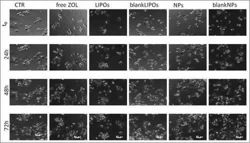 Figure 7. Representative time-lapse images of EPN cells for a qualitative comparison of ZOL delivery systems. Pictures were taken at 24 h intervals. Scale bar, 100 μm.